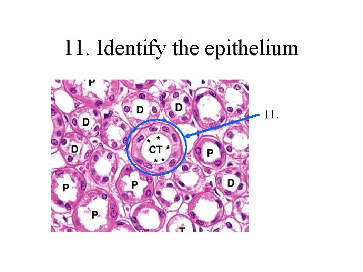 11. Identify the epithelium 11. 