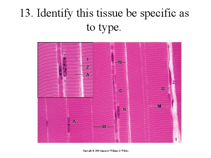 13. Identify this tissue be specific as to type. 