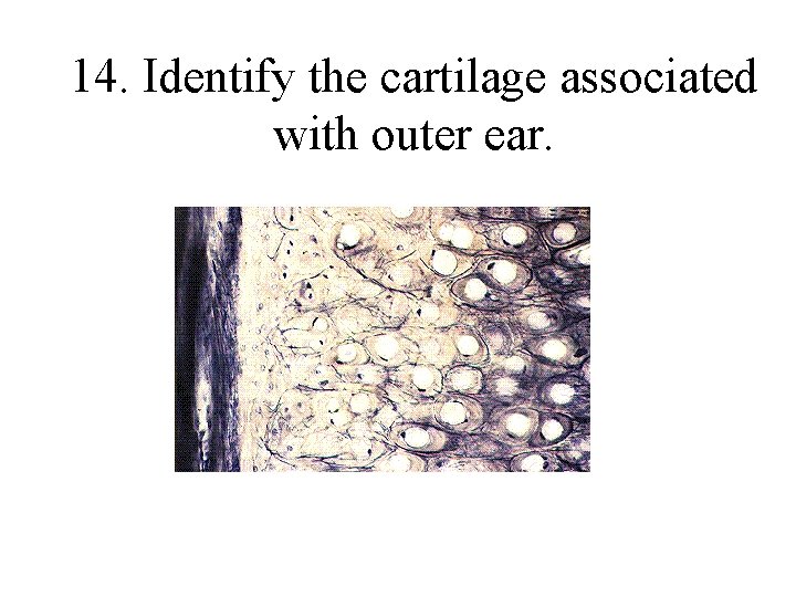 14. Identify the cartilage associated with outer ear. 
