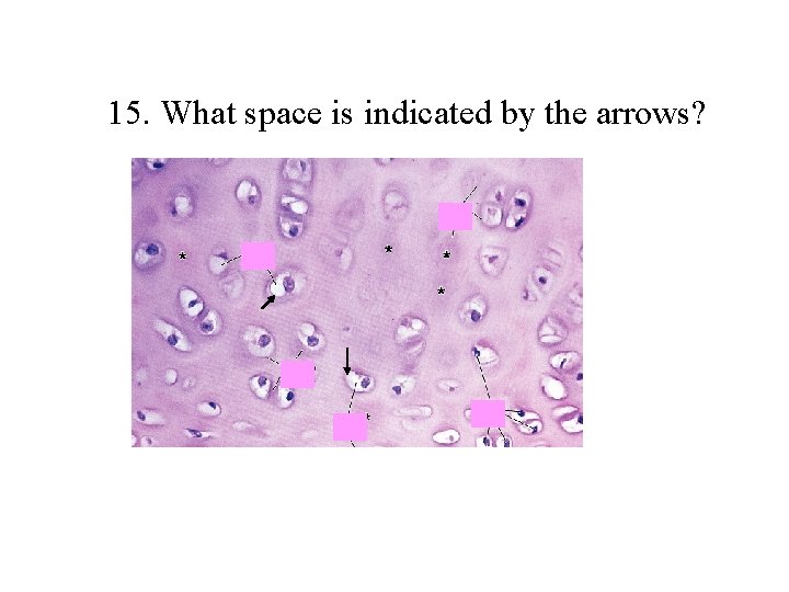 15. What space is indicated by the arrows? 