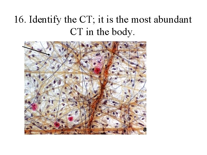 16. Identify the CT; it is the most abundant CT in the body. 