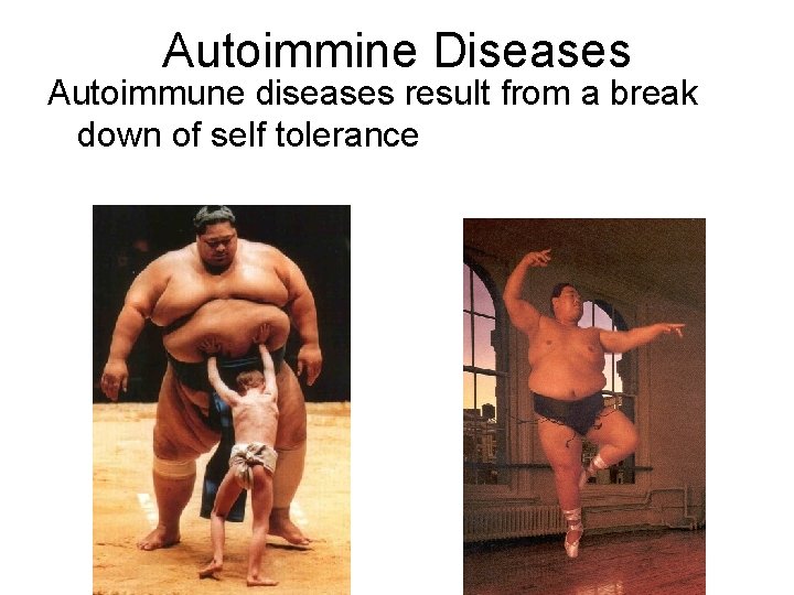 Autoimmine Diseases Autoimmune diseases result from a break down of self tolerance 