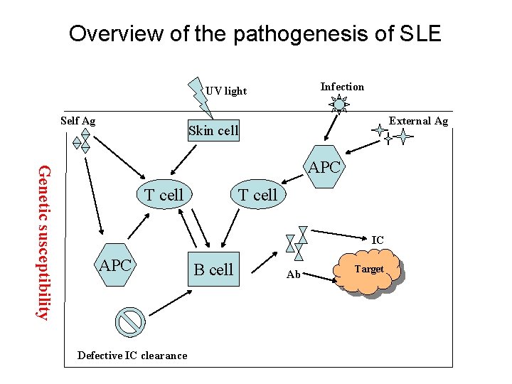 Overview of the pathogenesis of SLE Infection UV light Self Ag External Ag Skin