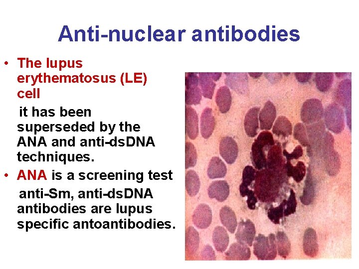 Anti-nuclear antibodies • The lupus erythematosus (LE) cell it has been superseded by the