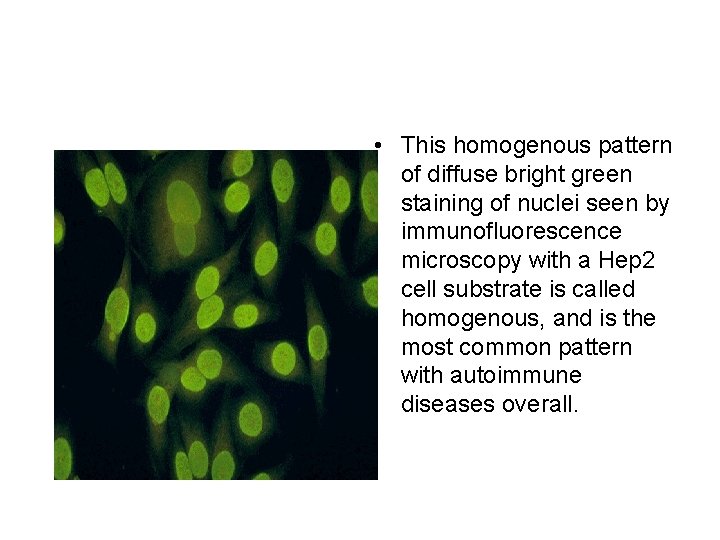  • This homogenous pattern of diffuse bright green staining of nuclei seen by