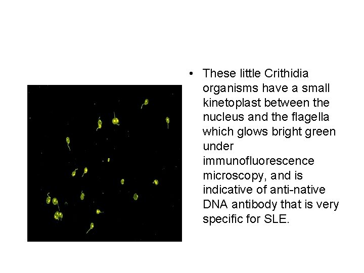  • These little Crithidia organisms have a small kinetoplast between the nucleus and