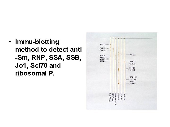  • Immu-blotting method to detect anti -Sm, RNP, SSA, SSB, Jo 1, Scl