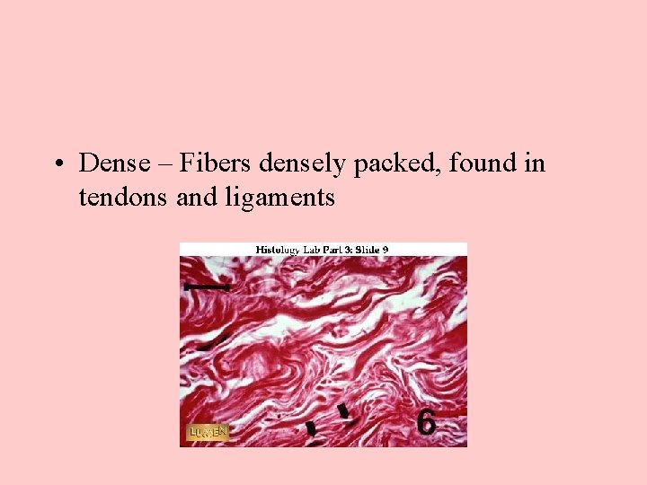  • Dense – Fibers densely packed, found in tendons and ligaments 