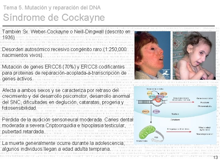 Tema 5. Mutación y reparación del DNA Síndrome de Cockayne También Sx. Weber-Cockayne o