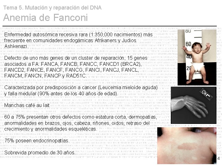 Tema 5. Mutación y reparación del DNA Anemia de Fanconi Enfermedad autosómica recesiva rara