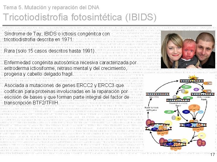 Tema 5. Mutación y reparación del DNA Tricotiodistrofia fotosintética (IBIDS) Síndrome de Tay, IBIDS