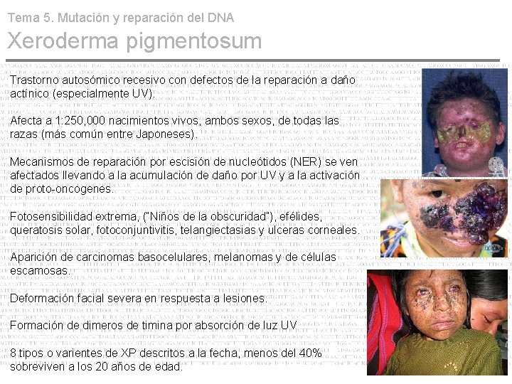 Tema 5. Mutación y reparación del DNA Xeroderma pigmentosum Trastorno autosómico recesivo con defectos