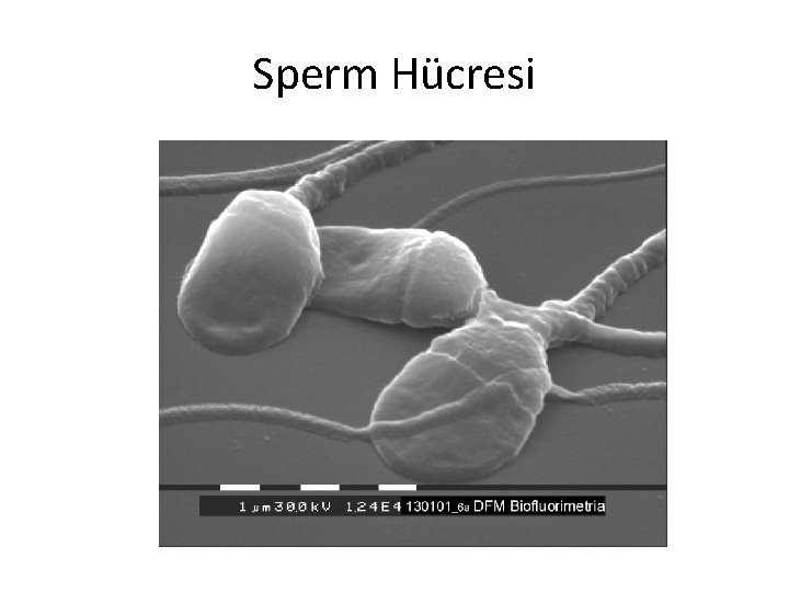 Sperm Hücresi 