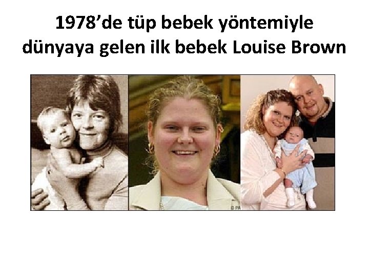 1978’de tüp bebek yöntemiyle dünyaya gelen ilk bebek Louise Brown 