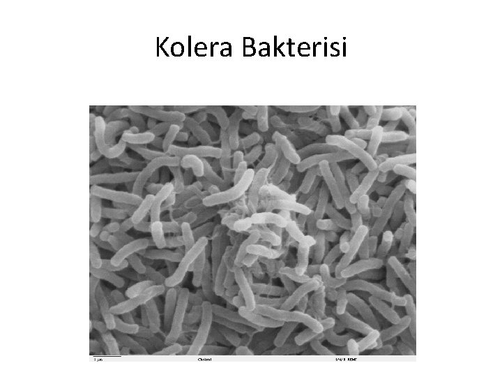 Kolera Bakterisi 