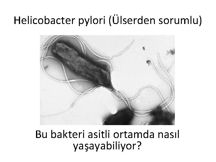 Helicobacter pylori (Ülserden sorumlu) Bu bakteri asitli ortamda nasıl yaşayabiliyor? 