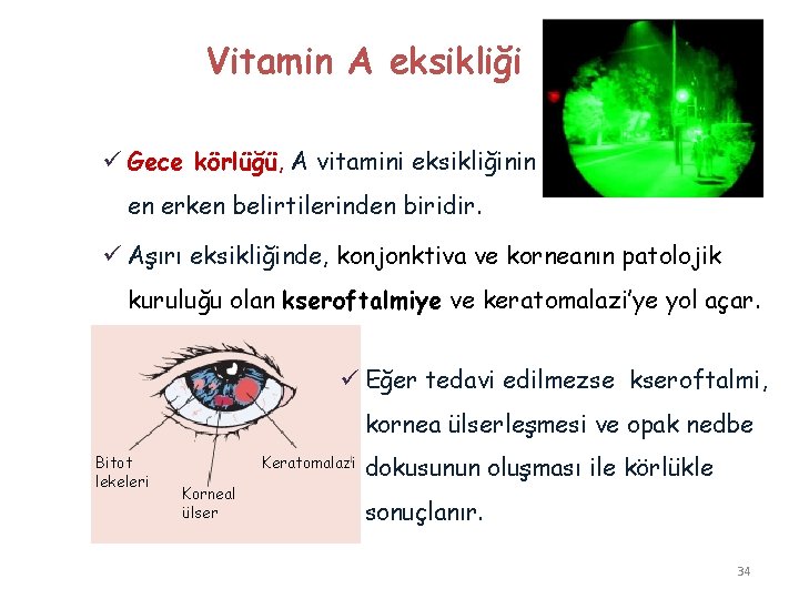 Vitamin A eksikliği ü Gece körlüğü, A vitamini eksikliğinin en erken belirtilerinden biridir. ü Vitamin A eksikliği ü Gece körlüğü, A vitamini eksikliğinin en erken belirtilerinden biridir. ü