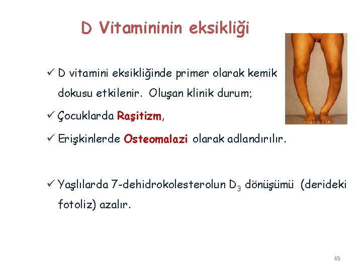 D Vitamininin eksikliği ü D vitamini eksikliğinde primer olarak kemik dokusu etkilenir. Oluşan klinik