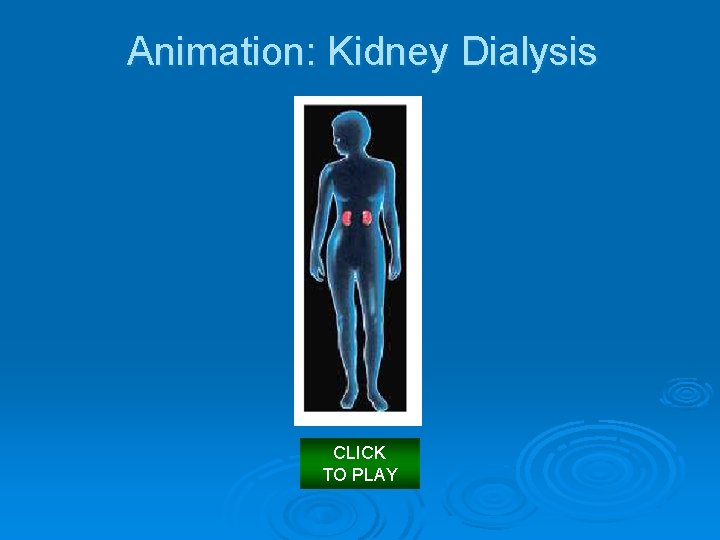 Animation: Kidney Dialysis CLICK TO PLAY 