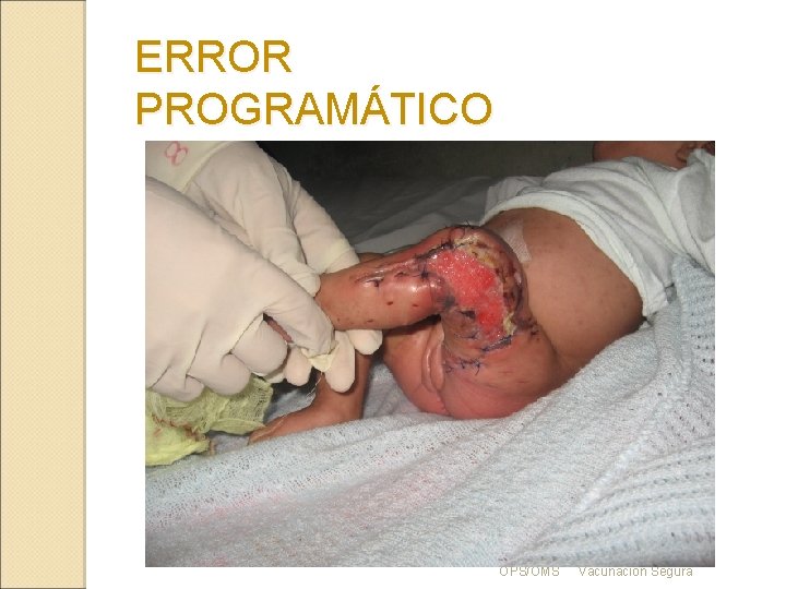 ERROR PROGRAMÁTICO OPS/OMS Vacunación Segura 