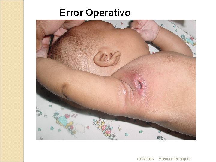 Error Operativo OPS/OMS Vacunación Segura 