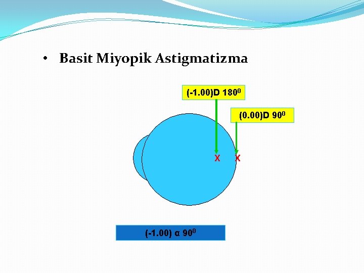  • Basit Miyopik Astigmatizma (-1. 00)D 1800 (0. 00)D 900 X (-1. 00)