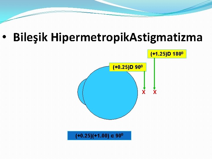  • Bileşik Hipermetropik. Astigmatizma (+1. 25)D 1800 (+0. 25)D 900 X (+0. 25)(+1.