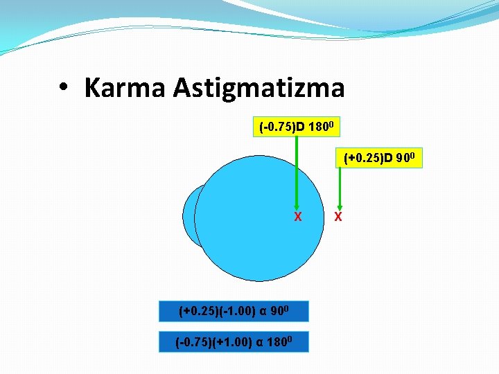  • Karma Astigmatizma (-0. 75)D 1800 (+0. 25)D 900 X (+0. 25)(-1. 00)