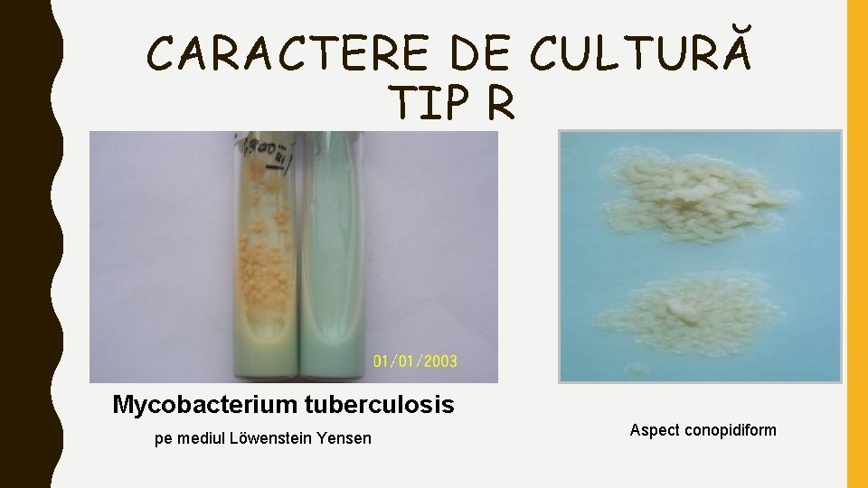 CARACTERE DE CULTURĂ TIP R Mycobacterium tuberculosis pe mediul Löwenstein Yensen Aspect conopidiform 