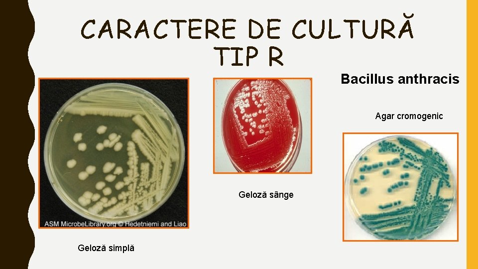 CARACTERE DE CULTURĂ TIP R Bacillus anthracis Agar cromogenic Geloză sânge Geloză simplă 