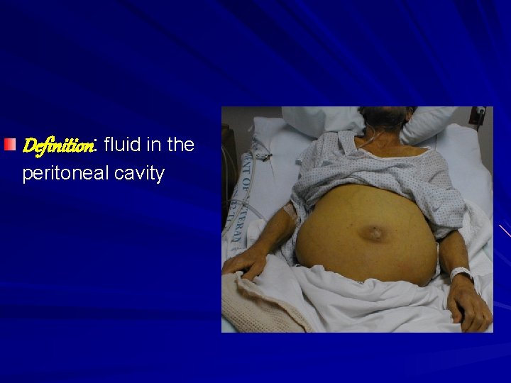 Definition: fluid in the peritoneal cavity 