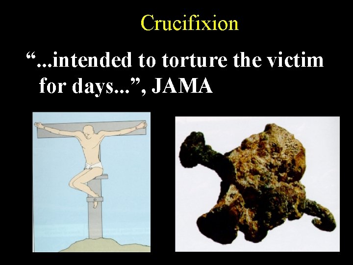 Crucifixion “. . . intended to torture the victim for days. . . ”,