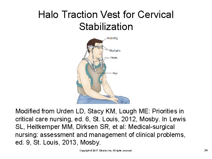 Halo Traction Vest for Cervical Stabilization Modified from Urden LD, Stacy KM, Lough ME: