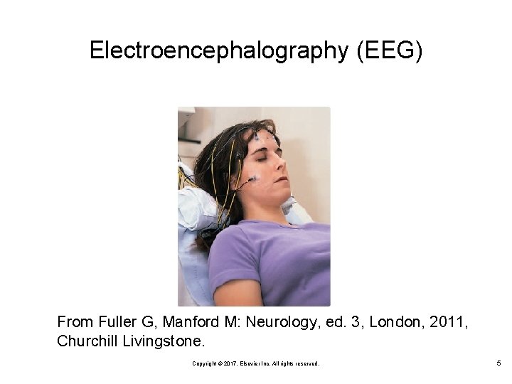 Electroencephalography (EEG) From Fuller G, Manford M: Neurology, ed. 3, London, 2011, Churchill Livingstone.