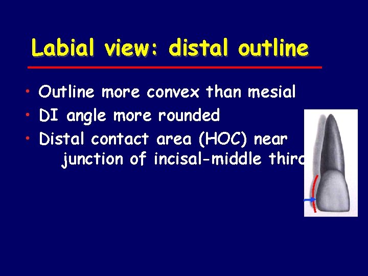 Labial view: distal outline • Outline more convex than mesial • DI angle more