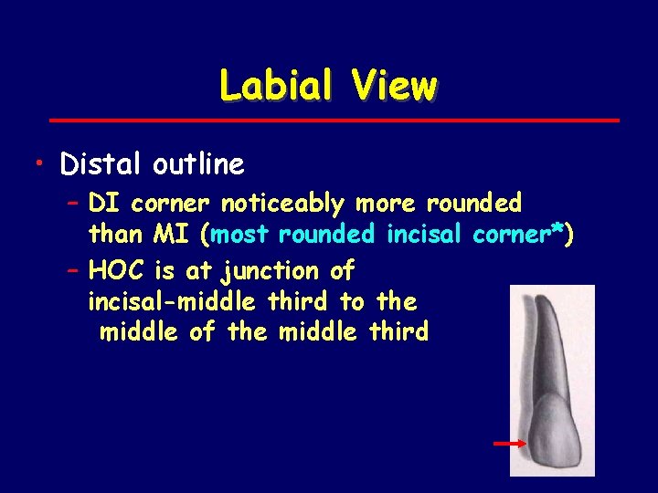 Labial View • Distal outline – DI corner noticeably more rounded than MI (most