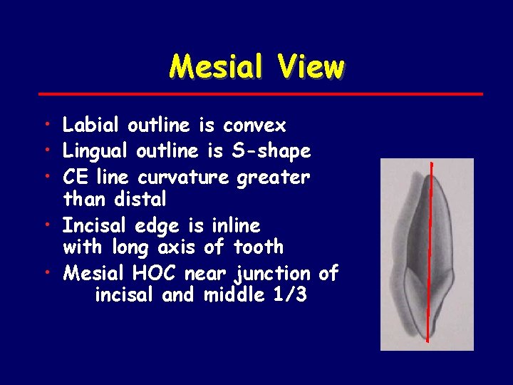 Mesial View • Labial outline is convex • Lingual outline is S-shape • CE