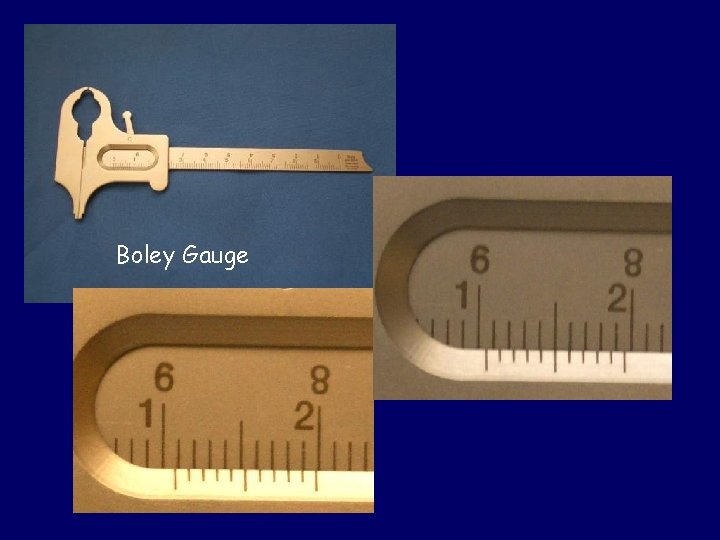 Boley Gauge 