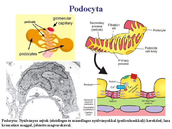 Podocyta: Nyúlványos sejtek (elsődleges és másodlagos nyúlványokkal (pediculusokkal)) kerekded, laza kromatinú maggal, jelentős magvacskával.