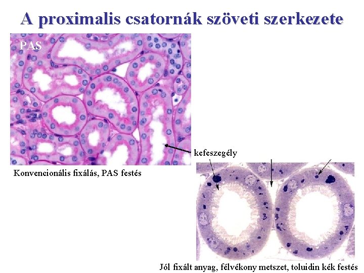 A proximalis csatornák szöveti szerkezete PAS kefeszegély Konvencionális fixálás, PAS festés Jól fixált anyag,