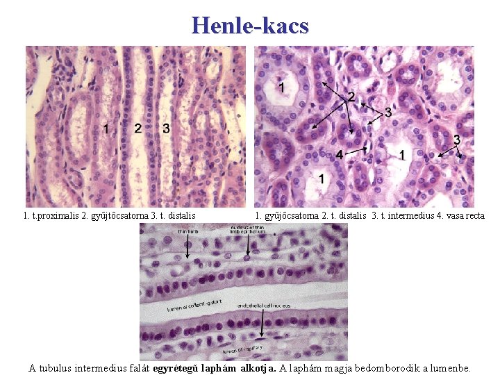 Henle-kacs 1. t. proximalis 2. gyűjtőcsatorna 3. t. distalis 1. gyűjőcsatorna 2. t. distalis