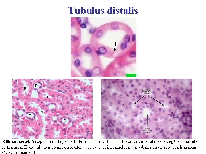 Tubulus distalis Köbhámsejtek (citoplazma világos festődésű, basalis csíkolat mitokondriumokkal), kefeszegély nincs, éles sejthatárok. Közöttük