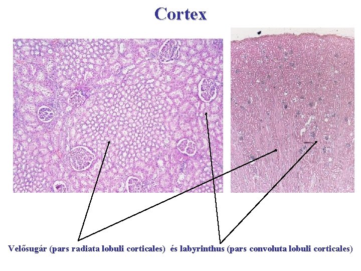 Cortex Velősugár (pars radiata lobuli corticales) és labyrinthus (pars convoluta lobuli corticales) 