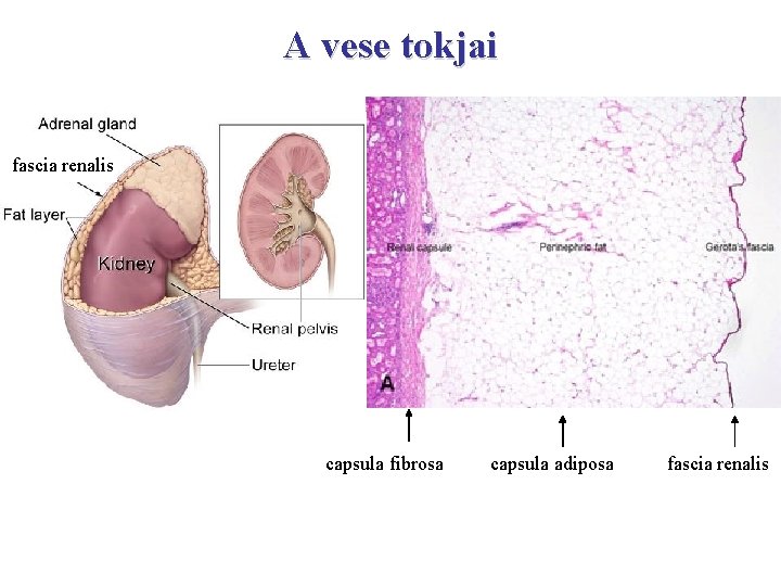A vese tokjai fascia renalis capsula fibrosa capsula adiposa fascia renalis 