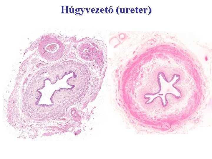 Húgyvezető (ureter) 