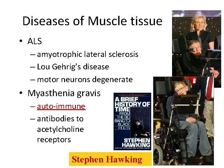 Diseases of Muscle tissue • ALS – amyotrophic lateral sclerosis – Lou Gehrig’s disease