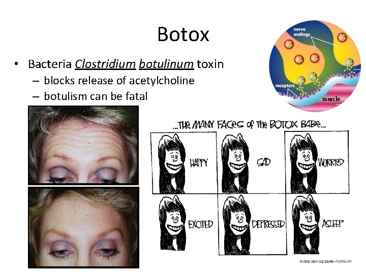 Botox • Bacteria Clostridium botulinum toxin – blocks release of acetylcholine – botulism can