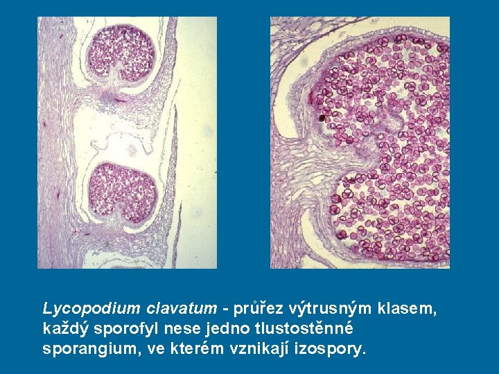 Lycopodium clavatum - průřez výtrusným klasem, každý sporofyl nese jedno tlustostěnné sporangium, ve kterém