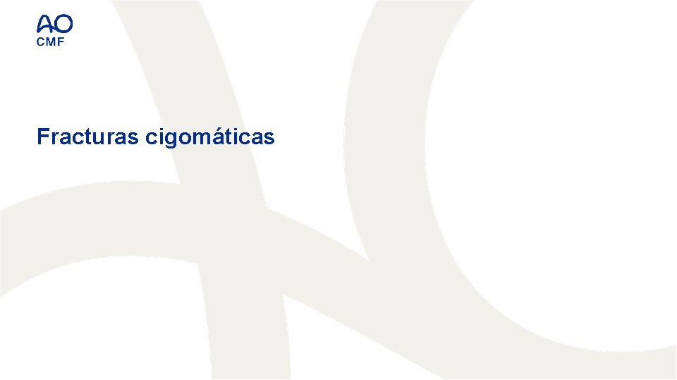 Fracturas cigomáticas 