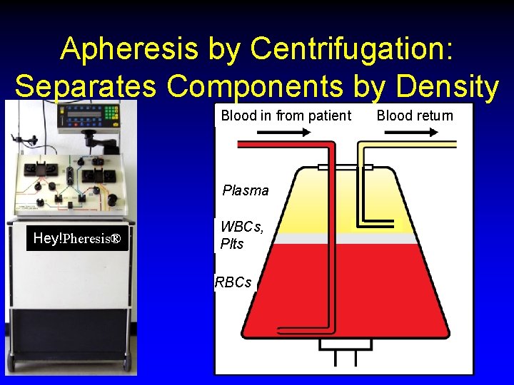 Apheresis by Centrifugation: Separates Components by Density Blood in from patient Plasma Hey!Pheresis® WBCs,